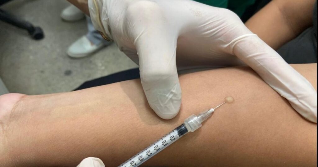 Quem precisa investigar infecção latente por tuberculose na rede de Manaus