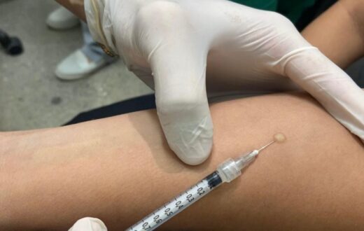 Quem precisa investigar infecção latente por tuberculose na rede de Manaus